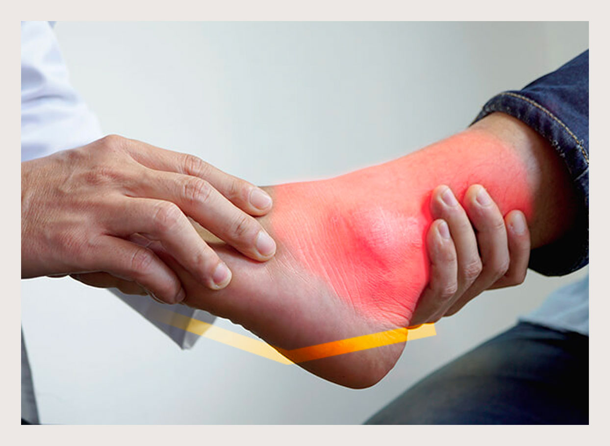 Woman with a swollen ankle, showing signs of pain and inflammation